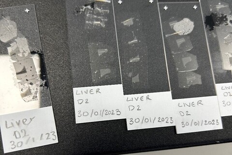 Liver protein analysis strips