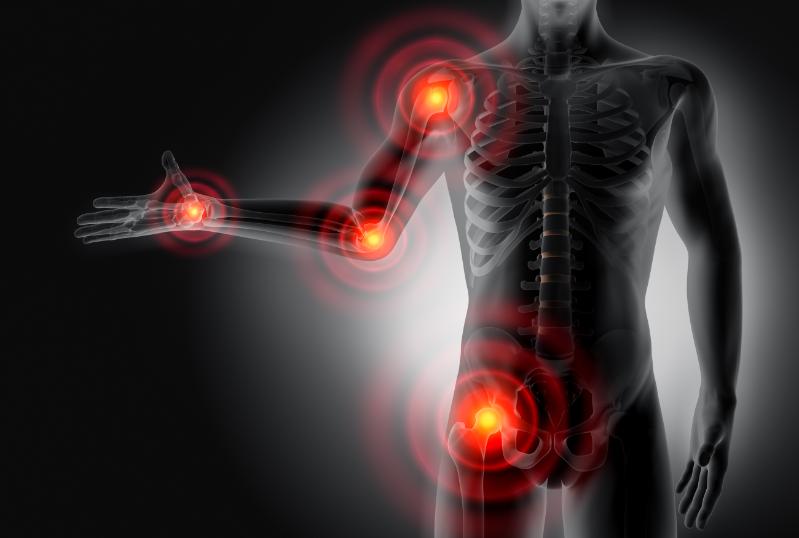 Locations of soft tissue injury